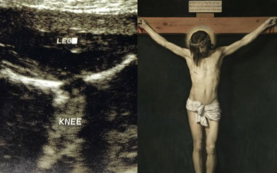 Una ecografia sorprendente che mostra Cristo difendere un nascituro
